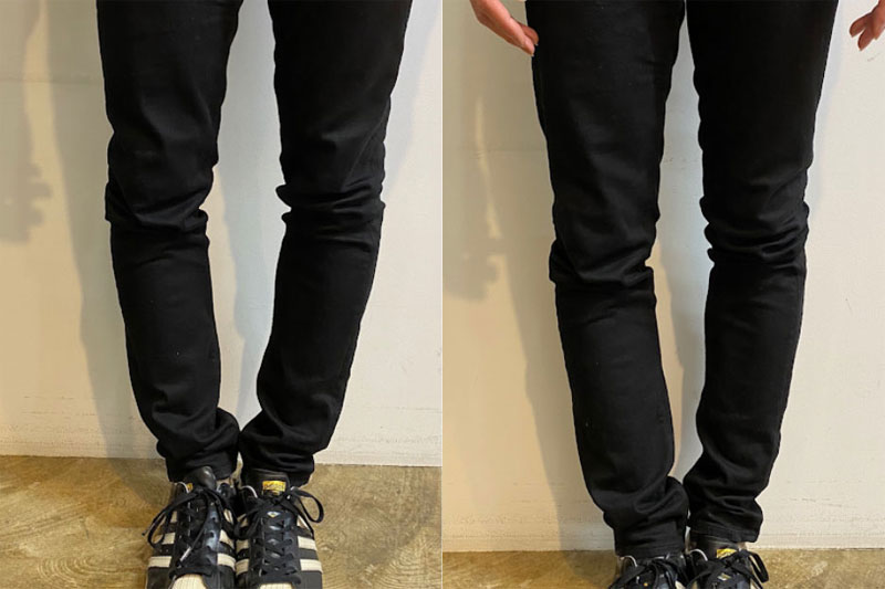 御徒町FOGSのO脚矯正